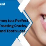 The Journey to a Perfect Smile: Treating Cracks