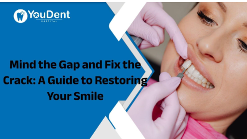 A Guide to Restoring Your Smile